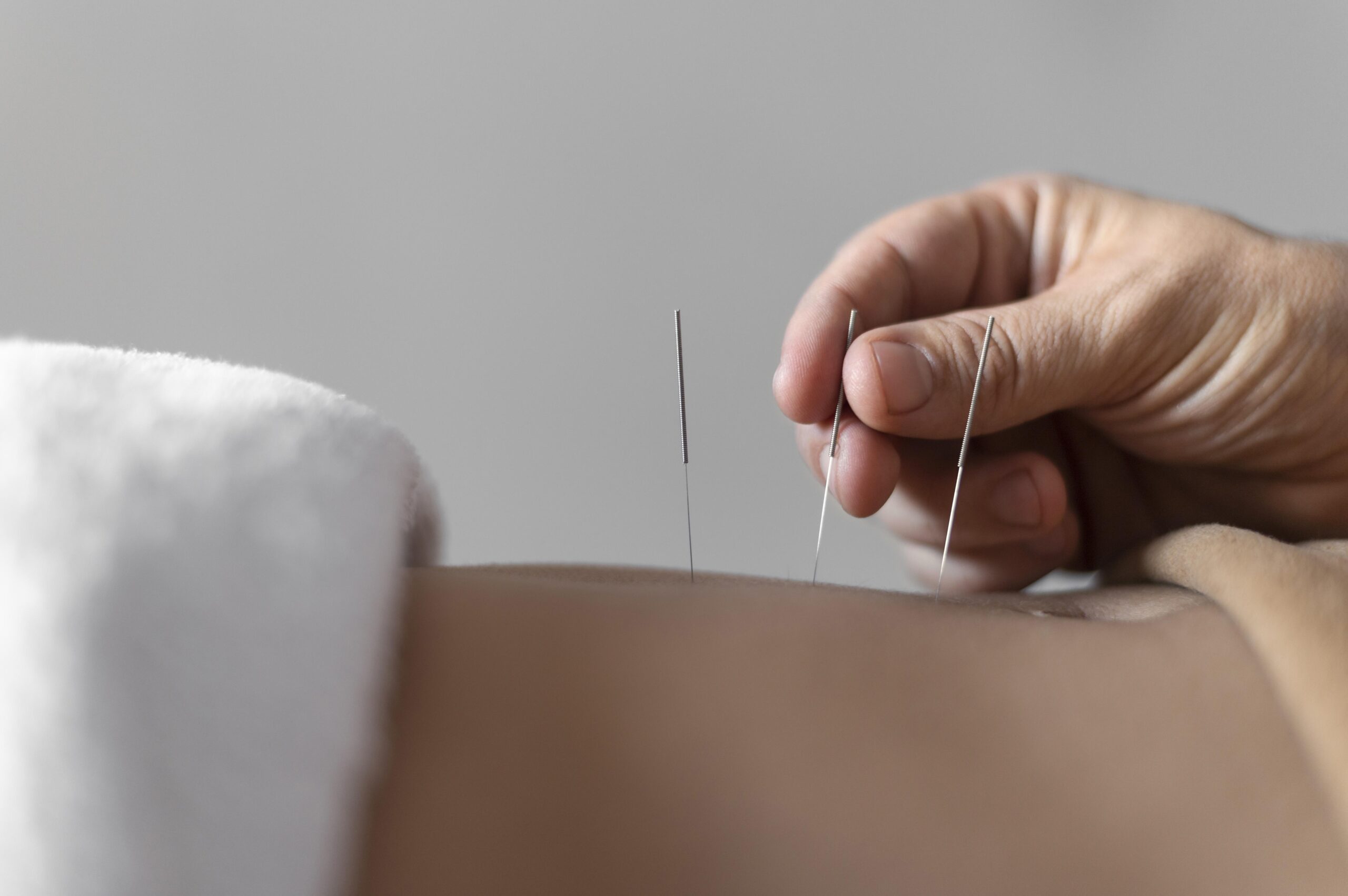 Galveston Dry Needling